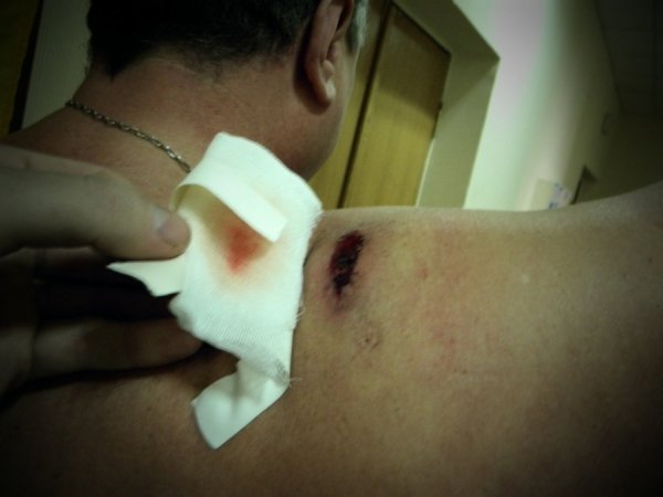 Фото поранених бійців Волинської сотні