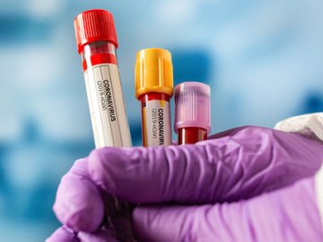 Усі – невакциновані: на Волині за добу виявили 14 нових заражених COVID-19