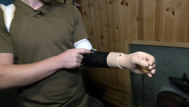 Воїн з Волині, який біля Кринок вратив руку і ноги, 14 днів чекав евакуації на острові