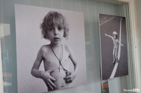 У Луцьку - виставка світлин про рак у дітей. ФОТО