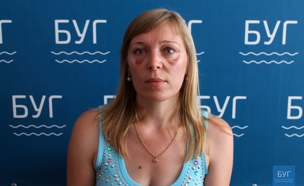 «Аліментів захотіла?» - на Волині чоловік побив колишню дружину. ФОТО. ВІДЕО. 18+