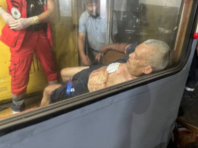 Окупанти знову вдарили по Херсону: є загиблі та поранені. ФОТО