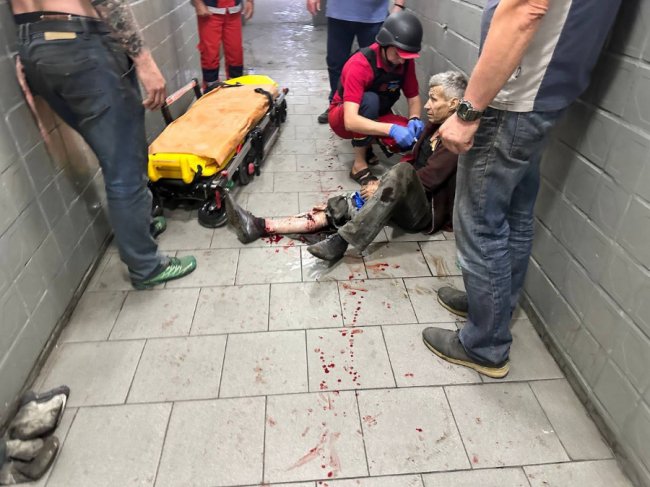 Окупанти знову вдарили по Херсону: є загиблі та поранені. ФОТО