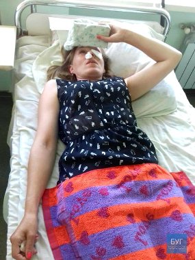 «Аліментів захотіла?» - на Волині чоловік побив колишню дружину. ФОТО. ВІДЕО. 18+