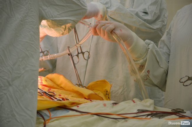 Другий шанс на життя: як у Луцьку оперують на відкритому серці. ФОТО 18+