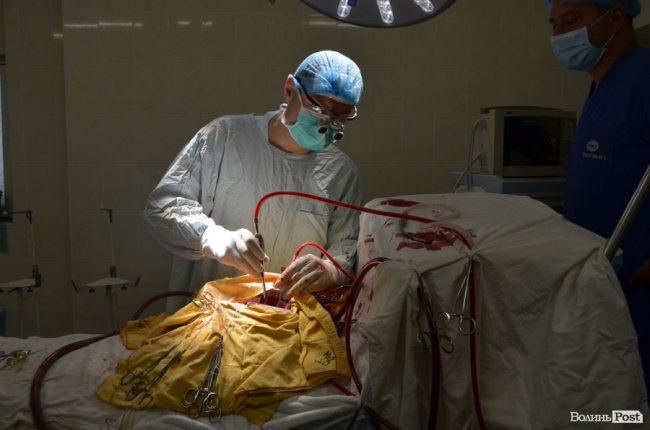 Другий шанс на життя: як у Луцьку оперують на відкритому серці. ФОТО 18+