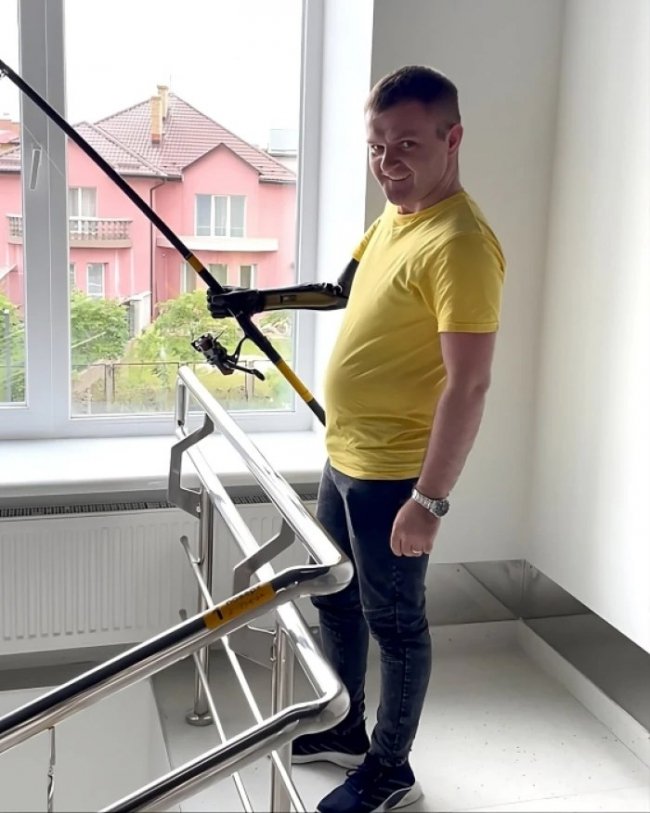 Воїну з Волині встановили сучасний біонічний протез руки