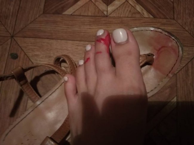 У ковельській маршрутці журналістка порізала ногу. ФОТО