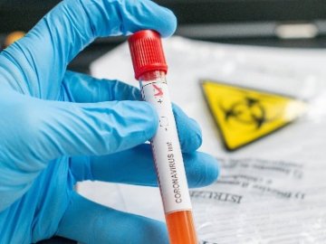 Оприлюднили статистику щодо коронавірусу в Україні за минулу добу