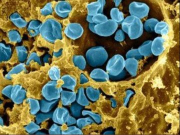 В Україні виявили інфекцію, проти якої немає вакцини