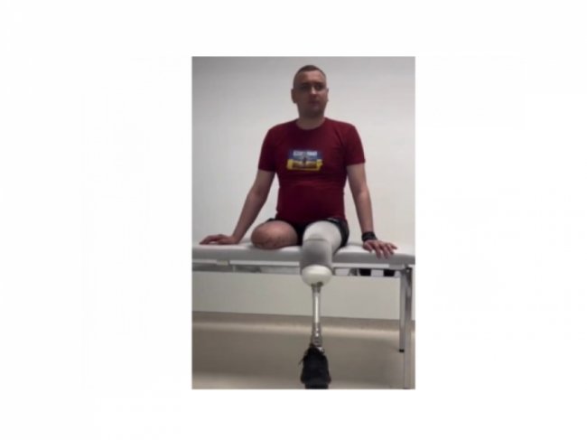 Втратив на війні обидві ноги: військовому, який одружився на фельдшерці з Луцька, встановили протези. ВІДЕО