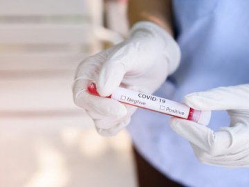 Повідомили кількість нових інфікованих коронавірусом за минулу добу