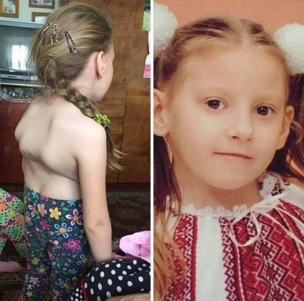  «Різдвяна зірка» у Луцьку: концерт заради благодійності