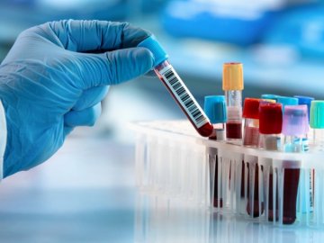 В Україні – 543 нові випадки коронавірусу станом на ранок 6 липня, з них на Волині – 47