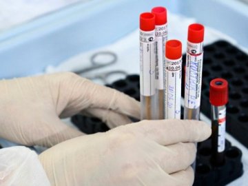 Де на Волині виявили нові випадки коронавірусу станом на 11 жовтня