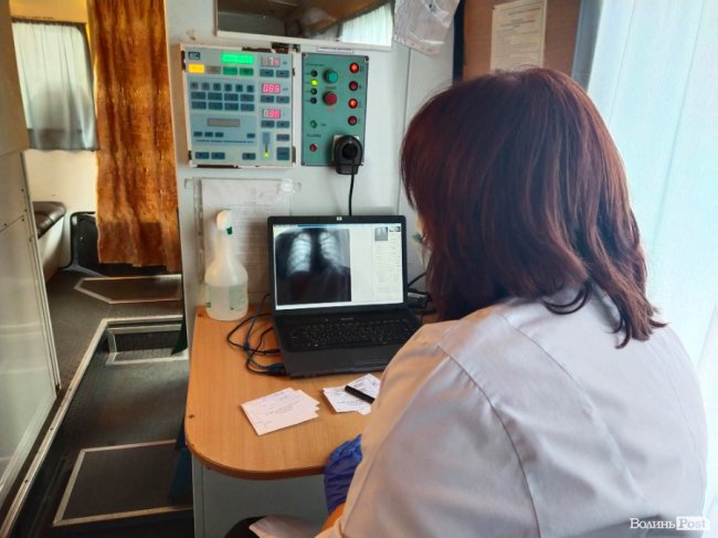 Лучан безкоштовно обстежували на наявність туберкульозу: які результати