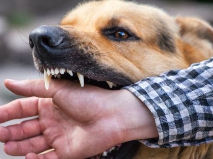 На Волині собака покусав чоловіка, господар заплатить штраф
