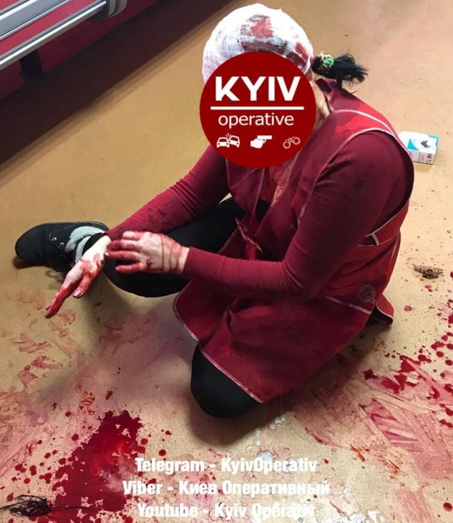У Києві чоловік з ножем порізав жінку-продавчиню. ФОТО 18+