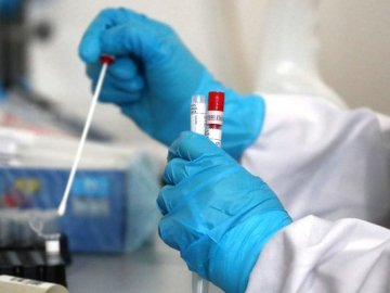 На Волині за минулу добу від коронавірусу померло 11 людей