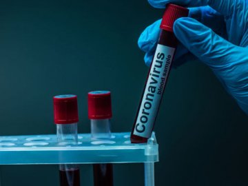 Яка ситуація з коронавірусом у  Ратнівському районі станом на 27 липня