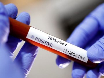 На Волині експрес-тести виявили коронавірус у двох людей, чекають остаточних результатів з Києва