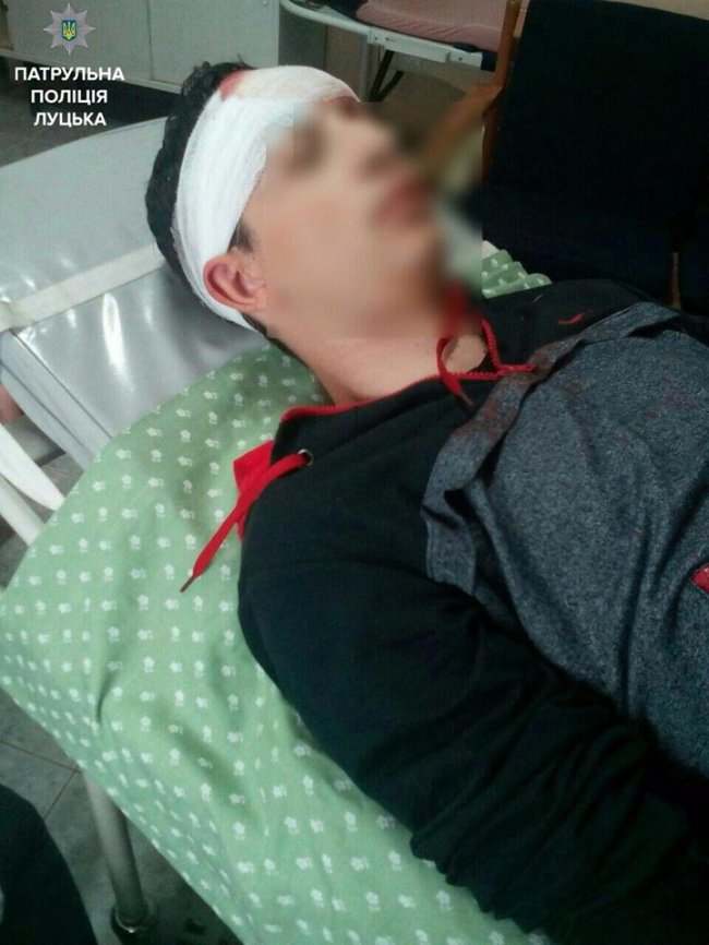 16-річний водій, який спричинив аварію в Луцьку, в реанімації