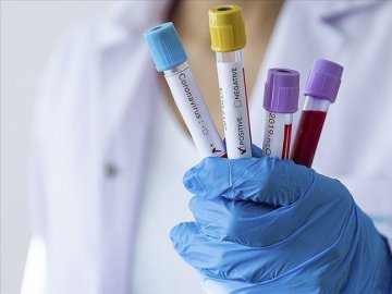 На Волині за добу — 13 смертей від COVID-19, 516 нових підтверджених випадків