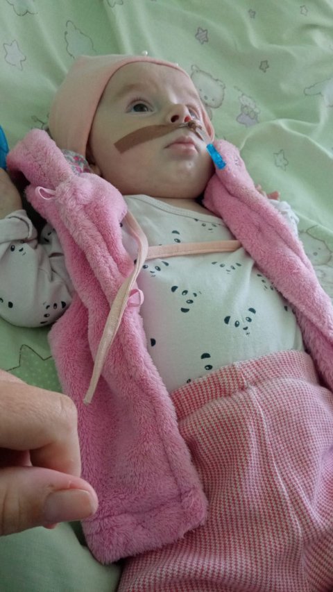 Семимісячній волинянці збирають гроші на найдорожчий у світі препарат Zolgensma, щоб вона вижила