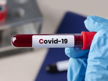 Де на Волині виявили 395 випадків COVID-19 за добу