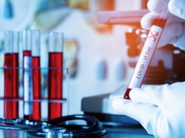 10 смертей та 424 хворих за добу: де на Волині виявили нові випадки коронавірусу