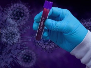 Повідомили статистику щодо коронавірусу в Україні за минулу добу