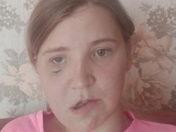 Вже зробили понад 10 операцій: дівчина з Волині, яка постраждала в ДТП, потребує фінансової допомоги