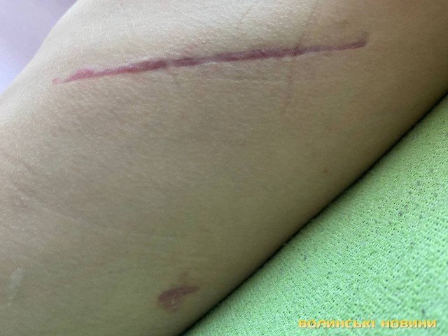 20-річний Семен Цикорський потребує коштів на дороговартісні медикаменти