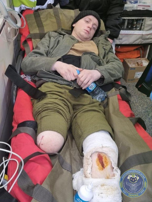 Україна передала РФ всіх важкопоранених, які потрапили в полон з початку вторгнення