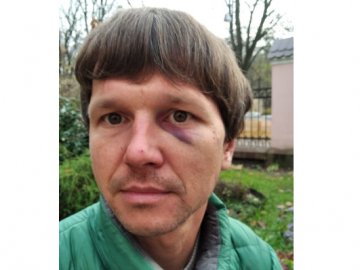 Поліцейський з Волині причетний до побиття ветеранів АТО у Львові, – ЗМІ