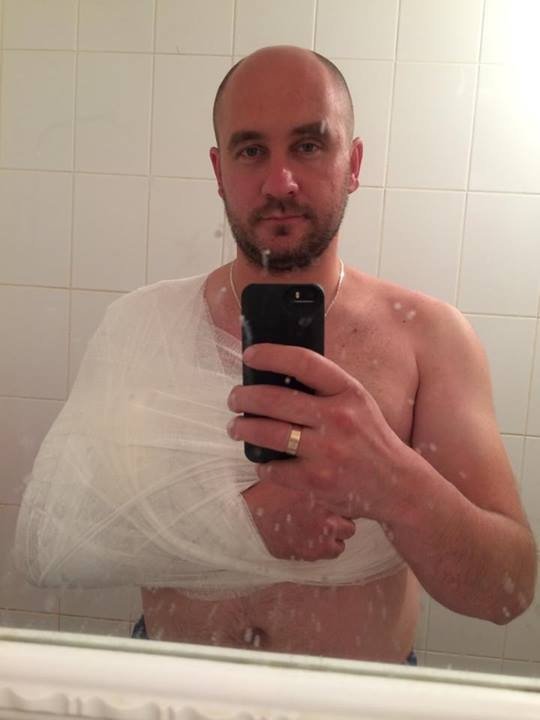 Бойовики поранили журналіста «Інтера». ФОТО