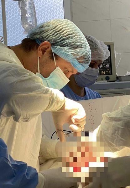 На Волині хірурги видалили в пацієнтки 4-кілограмову пухлину