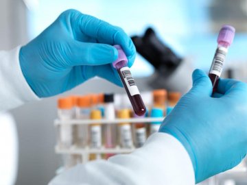 Ранок 23 липня: в Україні – 856 нових випадків коронавірусу, на Волині – 42