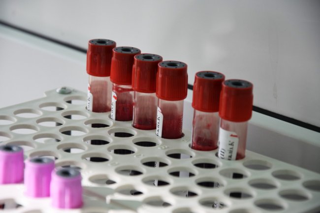 На Волині прикордонники вкотре стали донорами. ФОТО