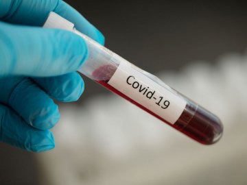 Де на Волині за останню добу зафіксували нові випадки коронавірусу 