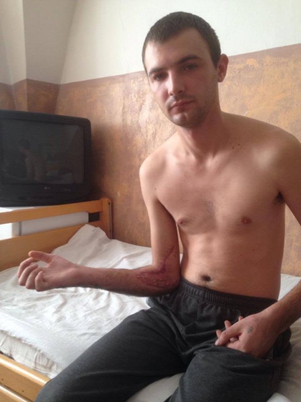 Бійцю з Нововолинська терміново необхідна реабілітація. ФОТО