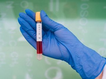 Оприлюднили статистику щодо коронавірусу в Україні за добу