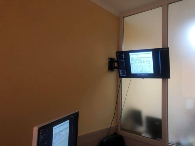 Для луцького пологового будинку придбали ультрасучасний УЗД апарат. ФОТО