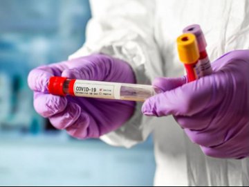 В Україні зафіксовано 914 нових випадків коронавірусної хвороби COVID-19 