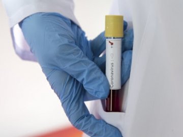 На Волині коронавірус виявили у 42 медпрацівників