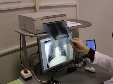 У центрі Луцька безкоштовно перевіряли на туберкульоз. ВІДЕО