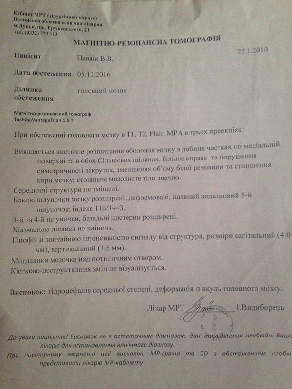 Маленькій дівчинці з Волині потрібні кошти на лікування