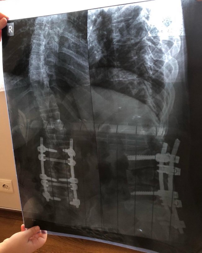 Молодій мамі з Луцька збирають кошти на операцію