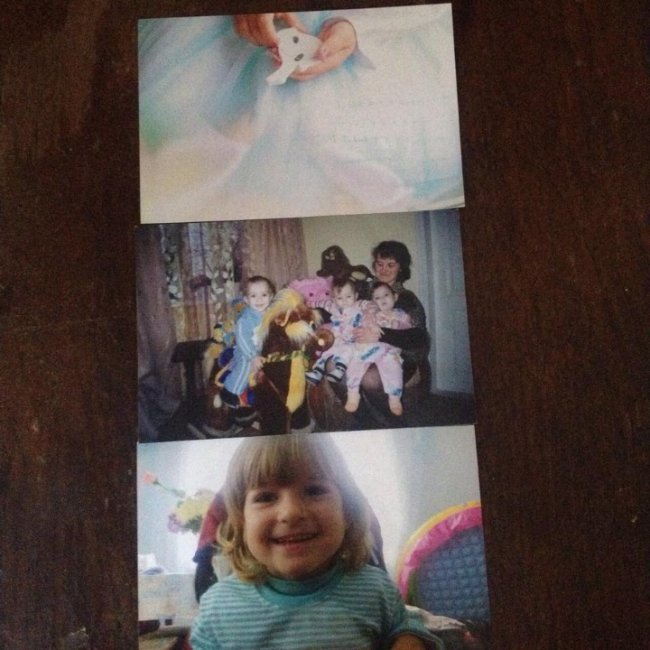 «Допоможіть врятувати дитину»: важкохворій волинянці необхідно зібрати 100 тисяч доларів на операцію. ФОТО