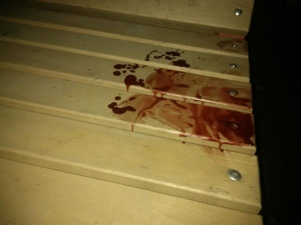 Неподалік «Версалю» - масова бійка з різаниною. Є постраждалі